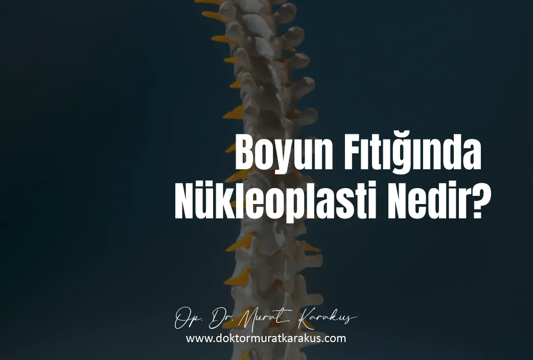 boyun-fitiginda-nukleoplasti-nedir