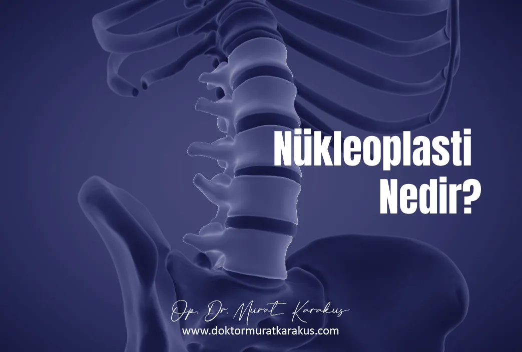 nükleoplasti nedir