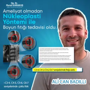 nukleoplasti-tedavisi-olmus-kisi.webp
