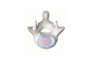 annulus-fibrosus-nedir