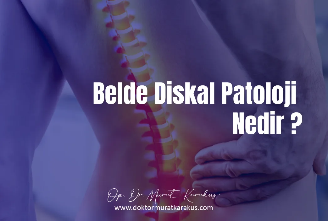 belde-diskal-patoloji-nedir