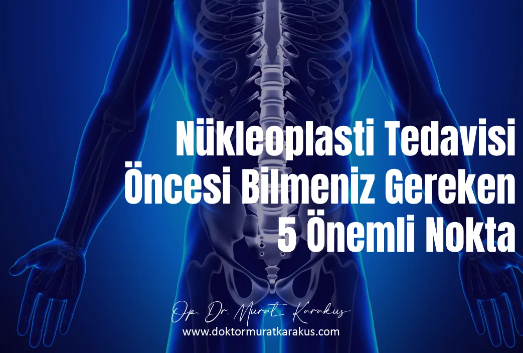 nukleoplasti-tedavisi-oncesi-bilmeniz-gereken-5-onemli-nokta-
