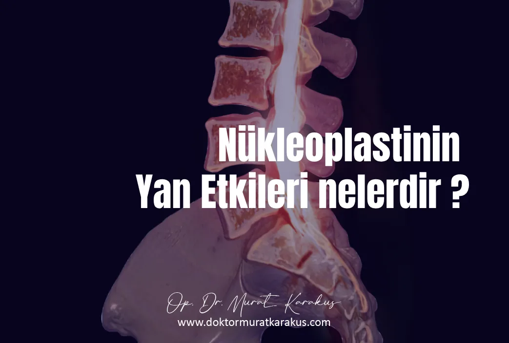 nukleoplastinin-yan-etkileri-nelerdir