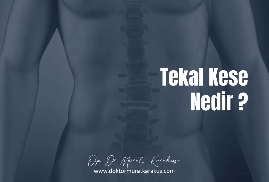 tekal-kese-nedir