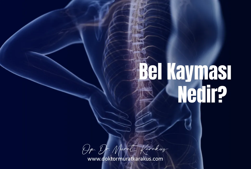 bel-kaymasi-nedir
