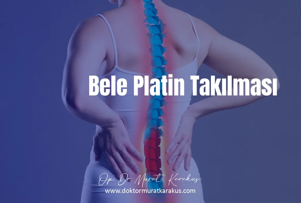 bele-platin-takilmasi-1043x704
