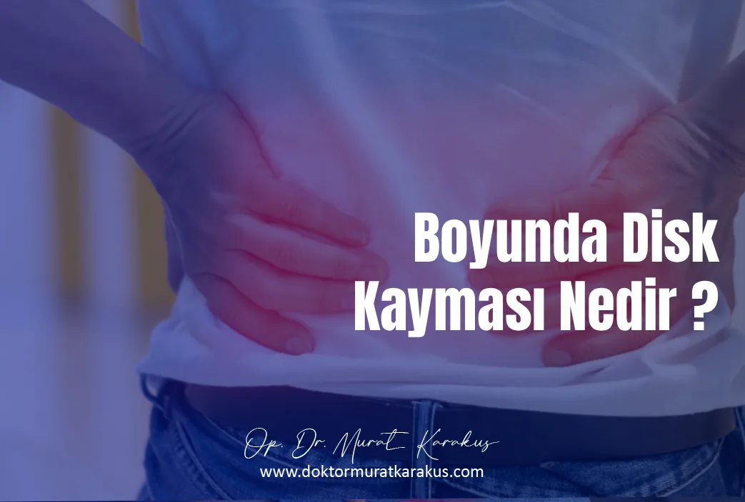 boyunda-disk-kaymasi-nedir