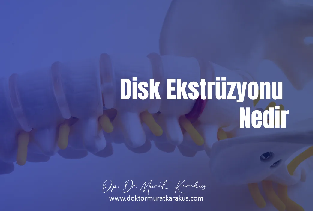 disk-ekstruzyonu-nedir