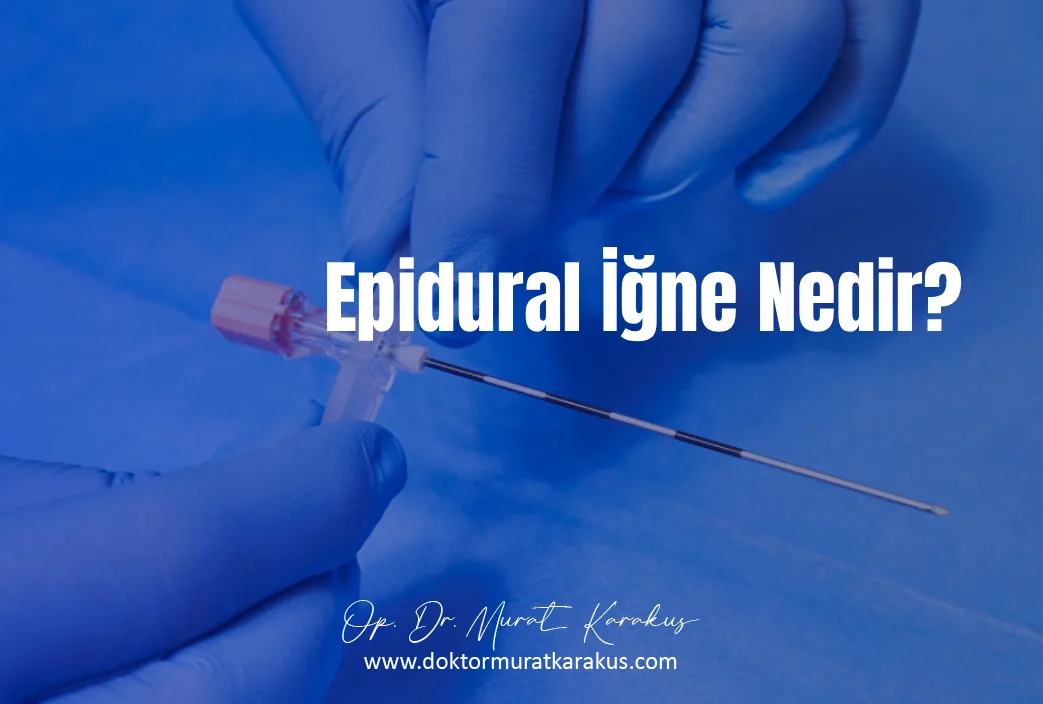 epidural-igne-nedir-