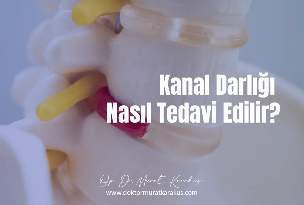 kanal-darligi-nasil-tedavi-edilir-1043x704