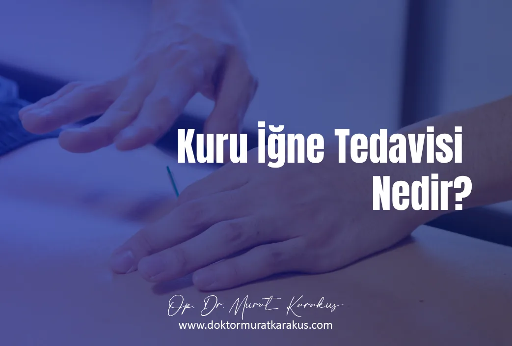 kuru-igne-tedavisi-nedi