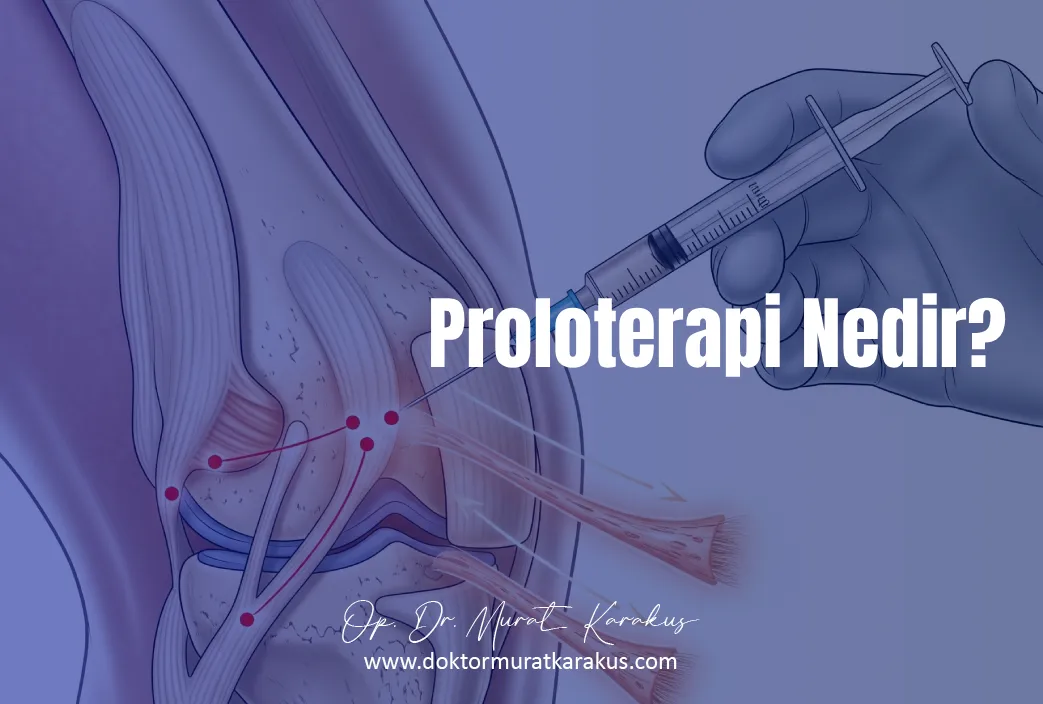 proloterapi-nedir