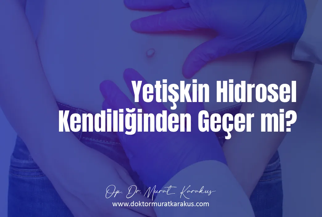 hidrosel-nedir-1043x704