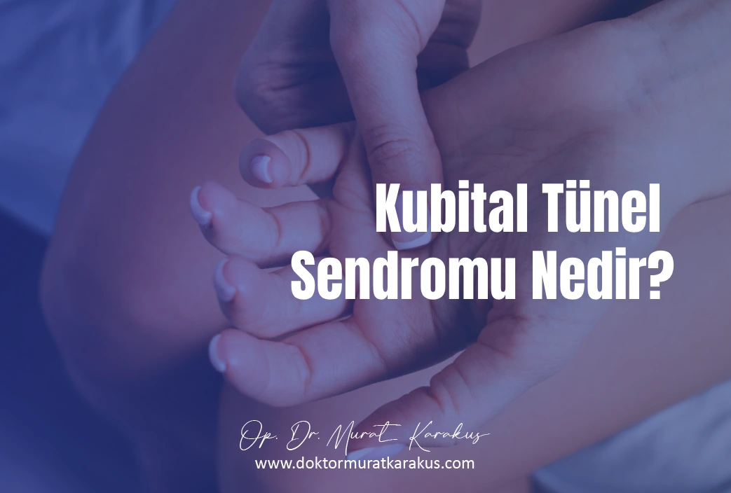 kubital-tunel-1043x704-1.webp