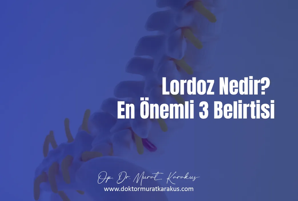 lordoz-nedir