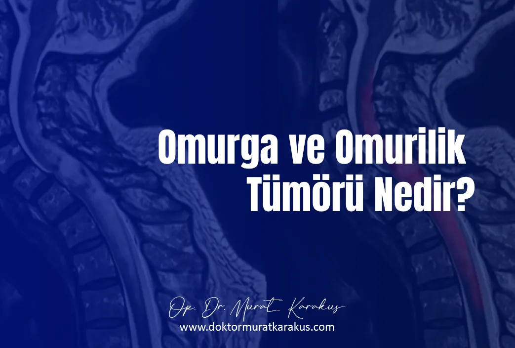 omurga-ve-omurilik-tumoru-nedir-1043x704