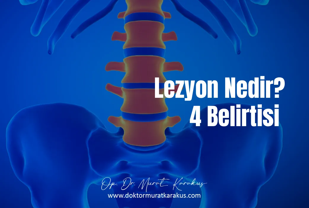 omurilikte-lezyon-nedir-4-belirtisi