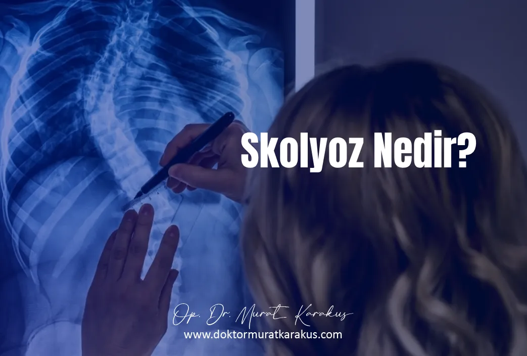 skolyoz-nedir