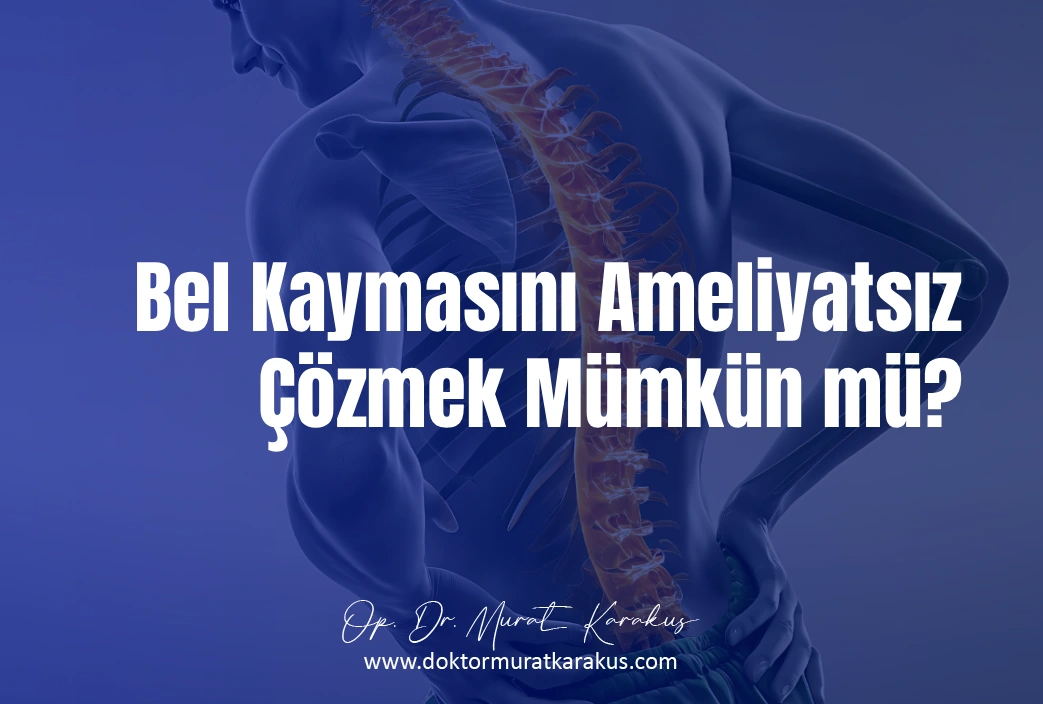 bel-kaymasini-ameliyatsiz-cozmek-mumkun-mu-1043X704.webp