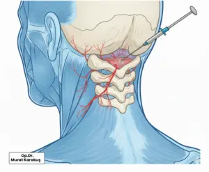 boyun-fitiginda-nokta-atisi-tedavisi-1024x843