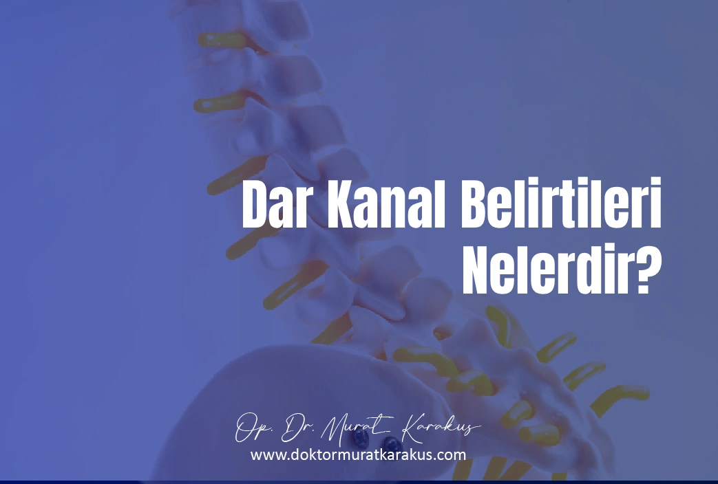 dar-kanal-belirtileri.webp