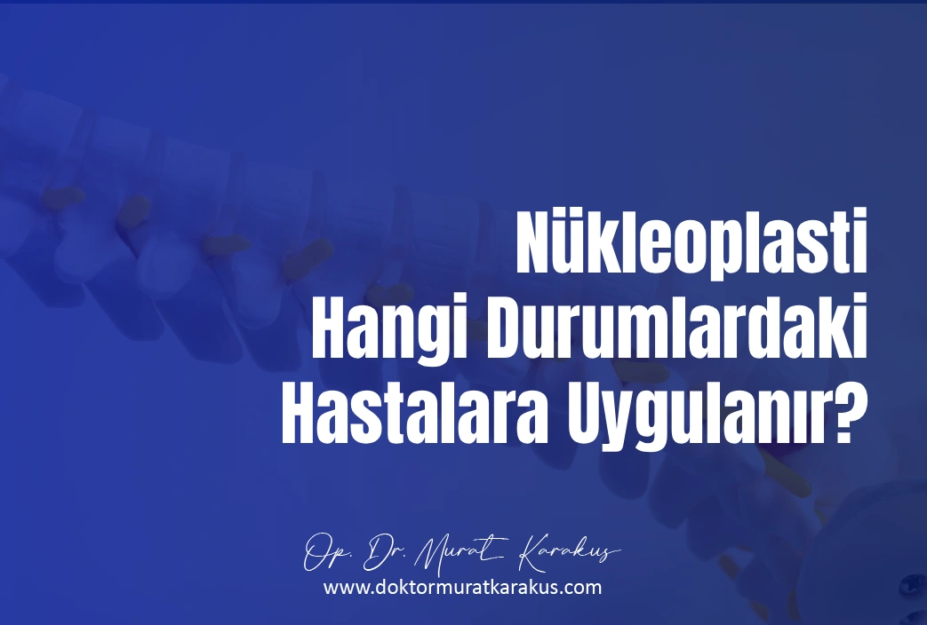 nukleoplasti-hangi-durumlardaki-hastalara-uygulanir-1043x704-1.webp