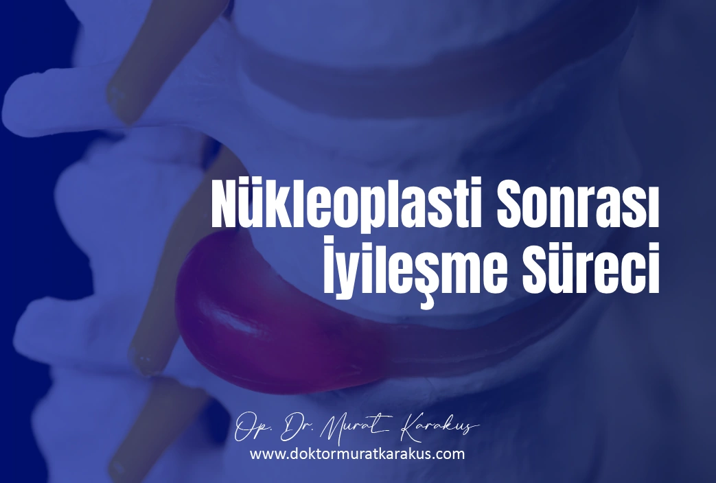 nukleoplasti-sonrasi-iyilesme-sureci-1043x704-1.webp