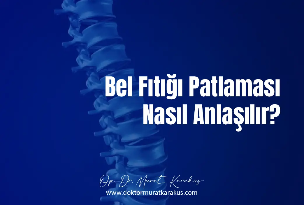 bel-fitigi-patlamasi-nasil-anlasilir-1043x704-1.webp