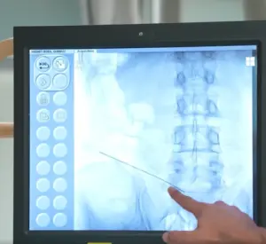 bel-agrisinin-nedeni-fitik-mi