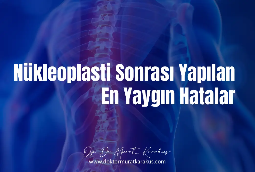 nukleoplasti-sonrasi-yapilan-en-yaygin-hatalar-1043x704-1.webp
