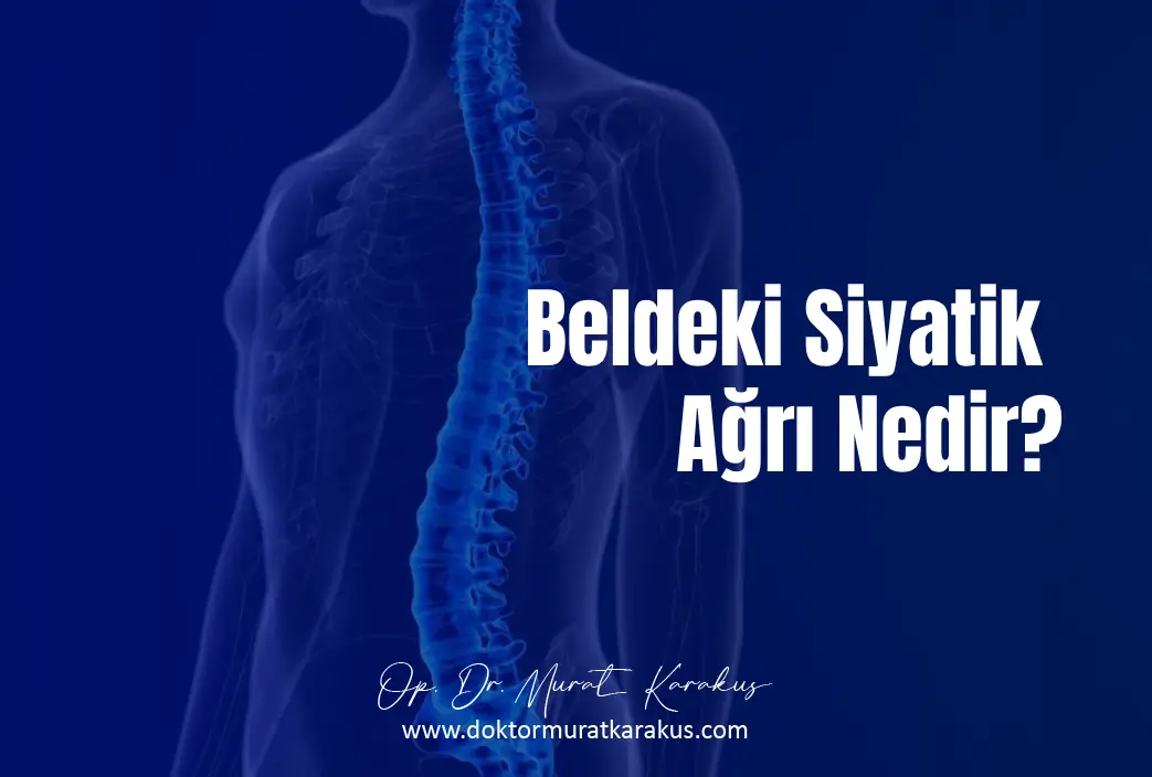 beldeki-siyatik-agri-nedir-1043x704-1.webp