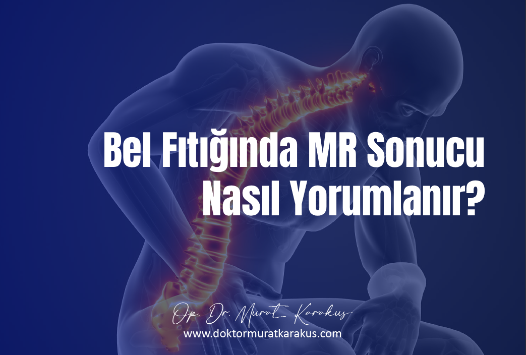 bel-fitiginda-mr-sonucu-nasil-yorumlanir-1043x704-1.webp